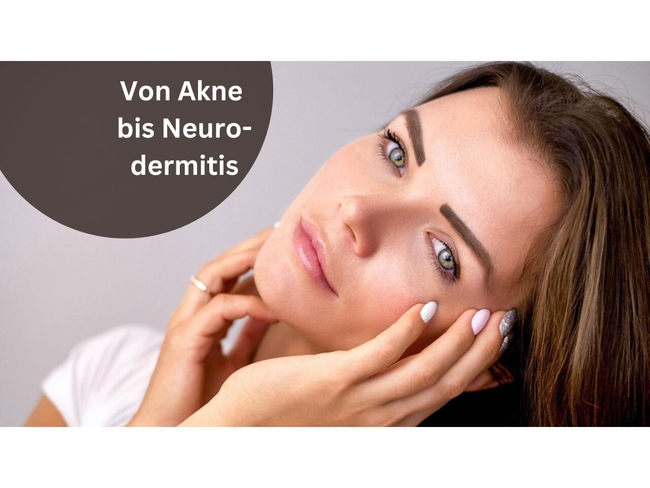 Von Akne bis Neurodermitis – mit Propolis auf natürliche Weise Linderung verschaffen - Akne &amp; Neurodermitis: Natürliche Hilfe mit Propolis