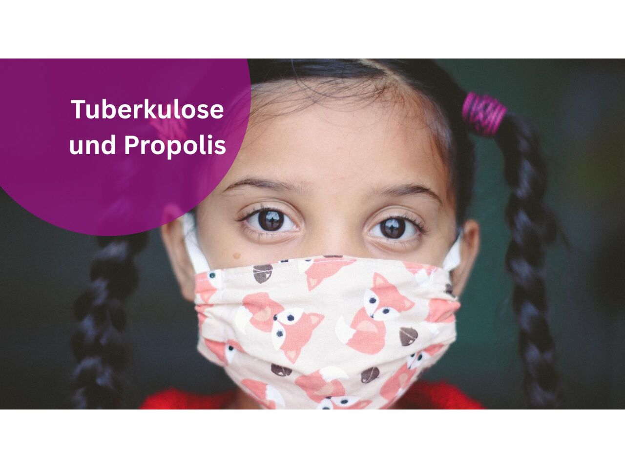 Tuberkulose &amp; Propolis – ein Hoffnungsschimmer in der Behandlung? - Tuberkulose &amp; Propolis – Behandlung &amp; Forschung