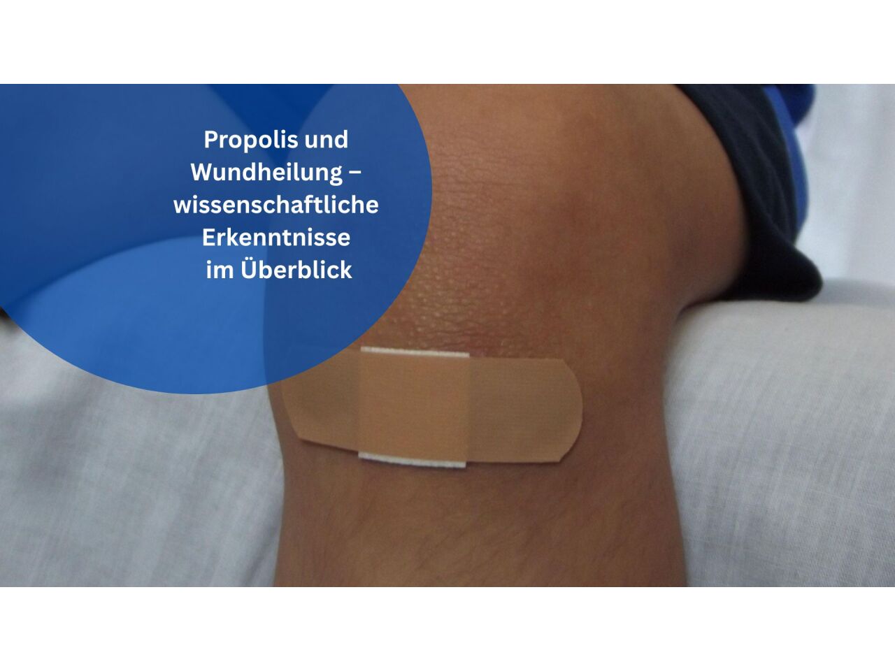 Propolis und Wundheilung – wissenschaftliche Erkenntnisse im Überblick - Propolis &amp; Wundheilung: Wissenschaftliche Erkenntnisse